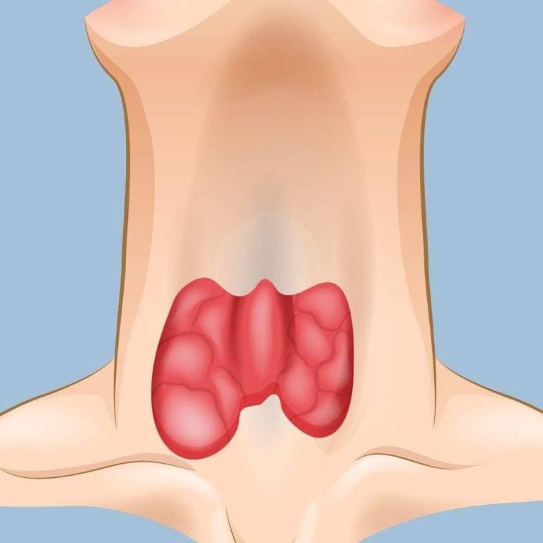 Ayurveda for Hypothyroidism