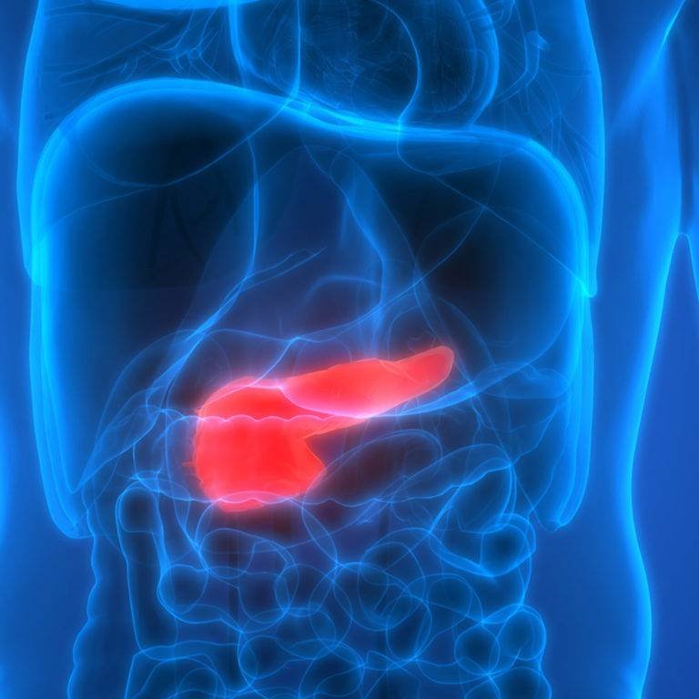 Use of Ayurveda in the Treatment of Type 2 Diabetes Mellitus