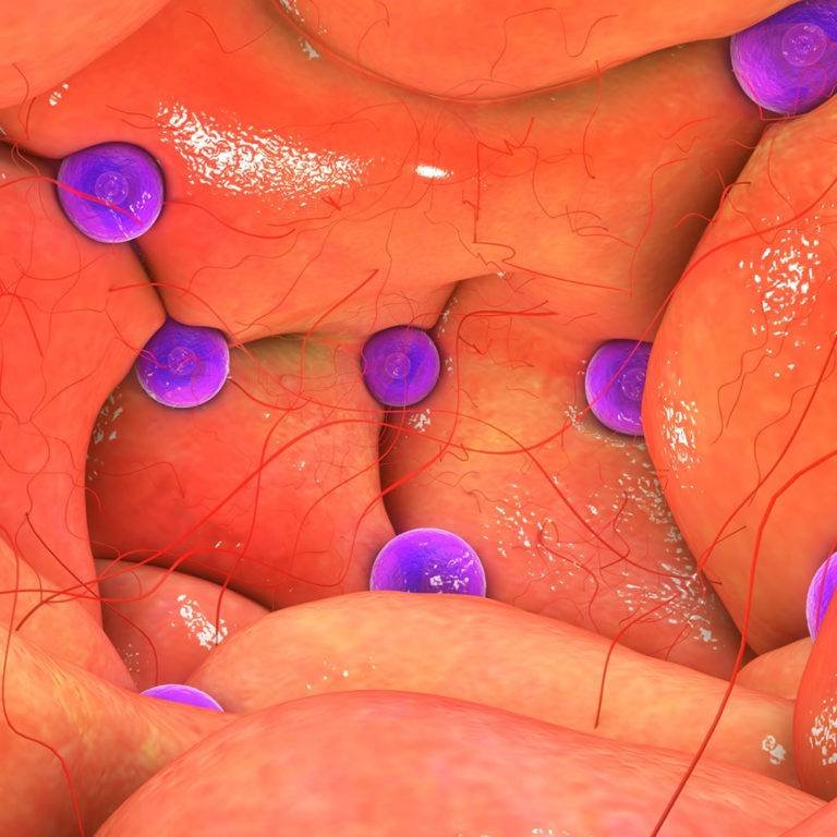 PCOS Ayurvedic Treatments