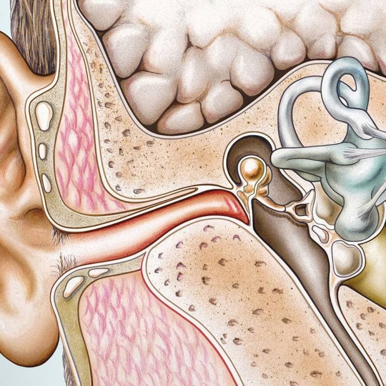 Tinnitus: Ringing in the ears and what to do about it