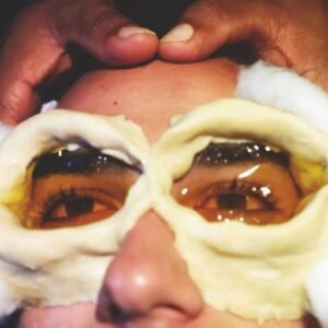 Close-up of a person undergoing Netra Basti, an Ayurvedic eye treatment, with medicated ghee applied around the eyes, enclosed by a dough ring.