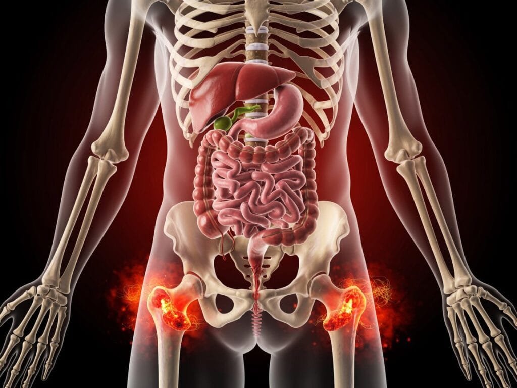 Ayurveda Arthritis Treatment