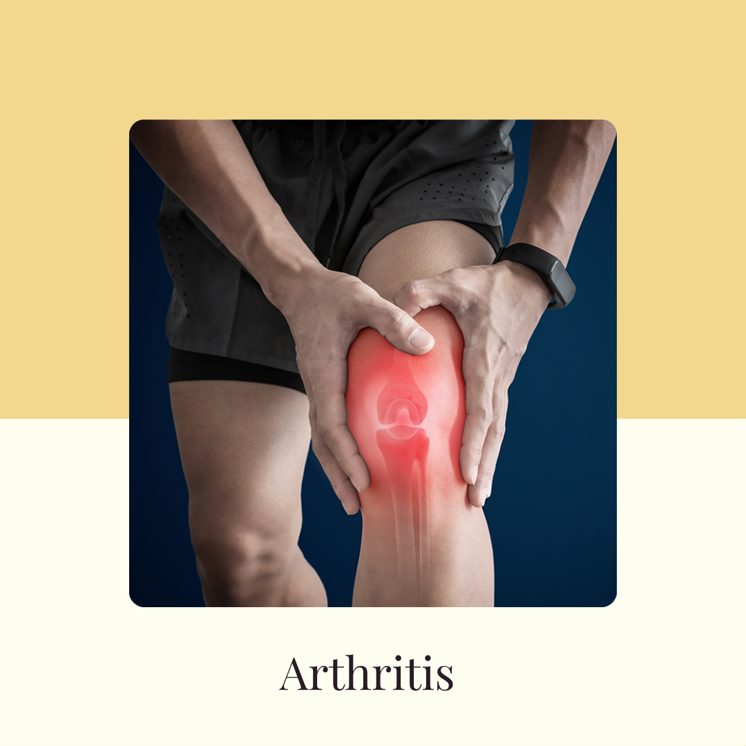Arthiritis