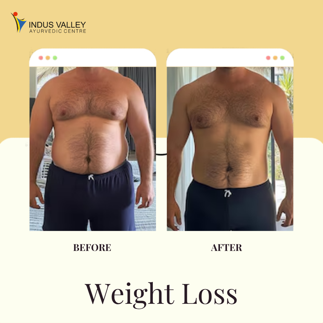 Green and Yellow Modern Traditional Minimalist Ayurveda Treatments Promote Instagram Post (1)