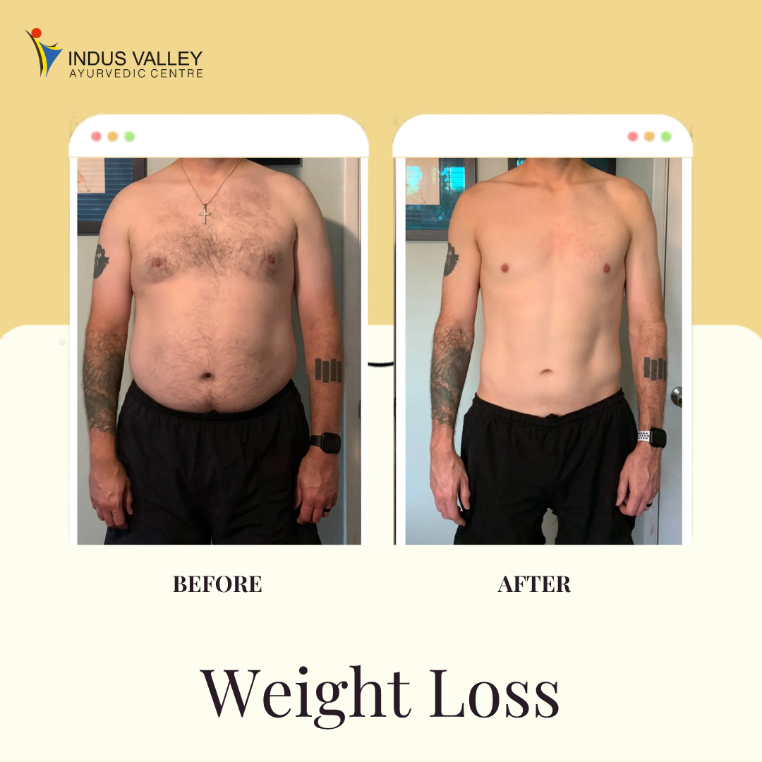 Green and Yellow Modern Traditional Minimalist Ayurveda Treatments Promote Instagram Post