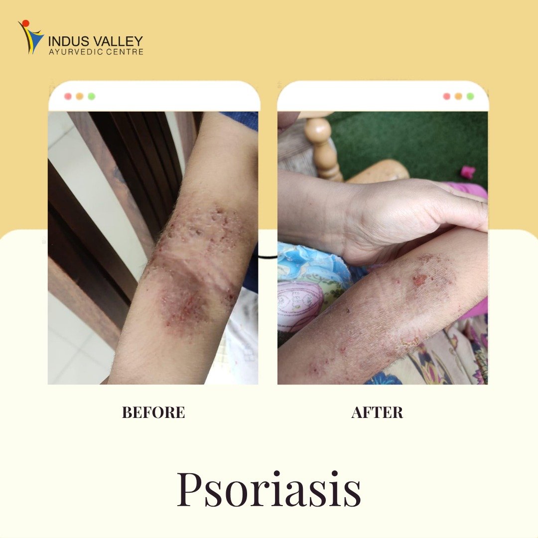 WhatsApp Image 2026-04-06 at 3.47.38 PM (2)