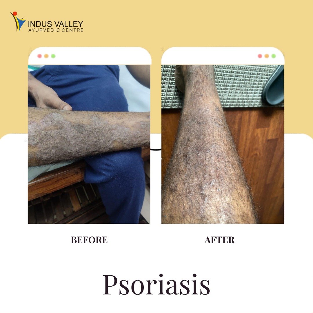 WhatsApp Image 2026-04-06 at 3.47.38 PM